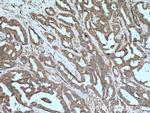 B4GALT3 Antibody in Immunohistochemistry (Paraffin) (IHC (P))