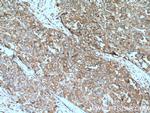 B4GALT3 Antibody in Immunohistochemistry (Paraffin) (IHC (P))