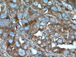 B4GALT3 Antibody in Immunohistochemistry (Paraffin) (IHC (P))