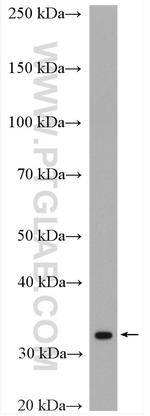 WBP1 Antibody in Western Blot (WB)