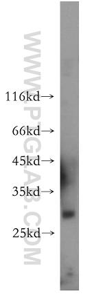 WBP1 Antibody in Western Blot (WB)