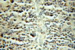 TFDP1 Antibody in Immunohistochemistry (Paraffin) (IHC (P))