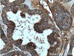 GNB5 Antibody in Immunohistochemistry (Paraffin) (IHC (P))