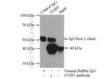GNB5 Antibody in Immunoprecipitation (IP)