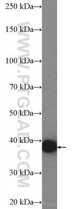 GNB5 Antibody in Western Blot (WB)