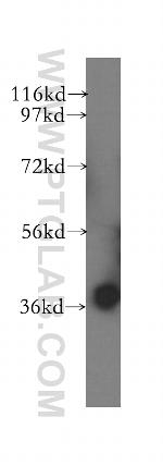 GNB5 Antibody in Western Blot (WB)