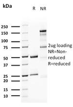 Uroplakin 1A (Urothelial Differentiation Marker) Antibody in SDS-PAGE (SDS-PAGE)