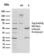 Uroplakin 1A (Urothelial Differentiation Marker) Antibody in SDS-PAGE (SDS-PAGE)