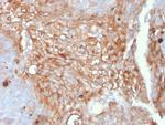 Uroplakin 1A Antibody in Immunohistochemistry (Paraffin) (IHC (P))