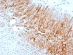 Uroplakin 1A (Urothelial Differentiation Marker) Antibody in Immunohistochemistry (Paraffin) (IHC (P))