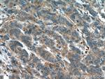 GSNOR/ADH5 Antibody in Immunohistochemistry (Paraffin) (IHC (P))