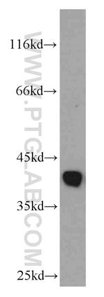 GSNOR/ADH5 Antibody in Western Blot (WB)