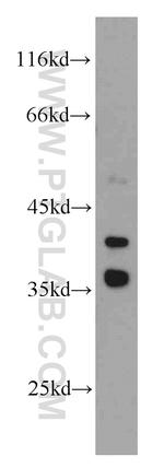 GSNOR/ADH5 Antibody in Western Blot (WB)