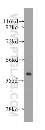 GSNOR/ADH5 Antibody in Western Blot (WB)