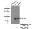 GANP Antibody in Immunoprecipitation (IP)