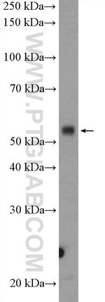 NONO Antibody in Western Blot (WB)