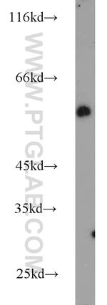 NONO Antibody in Western Blot (WB)