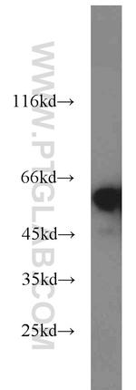 NONO Antibody in Western Blot (WB)