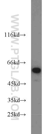 NONO Antibody in Western Blot (WB)