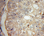 IL13RA2 Antibody in Immunohistochemistry (Paraffin) (IHC (P))