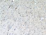 IL13RA2 Antibody in Immunohistochemistry (Paraffin) (IHC (P))