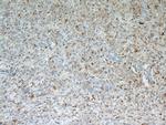 IL13RA2 Antibody in Immunohistochemistry (Paraffin) (IHC (P))