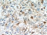 IL13RA2 Antibody in Immunohistochemistry (Paraffin) (IHC (P))