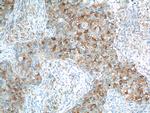 IL13RA2 Antibody in Immunohistochemistry (Paraffin) (IHC (P))