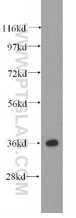 Annexin V Antibody in Western Blot (WB)