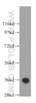 Annexin V Antibody in Western Blot (WB)