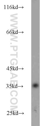 Annexin V Antibody in Western Blot (WB)