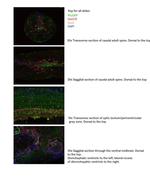 SOX2 Antibody in Immunohistochemistry (IHC)