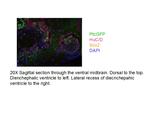 SOX2 Antibody in Immunohistochemistry (IHC)