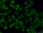 SOX2 Antibody in Immunocytochemistry (ICC/IF)