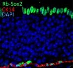 SOX2 Antibody in Immunohistochemistry (IHC)