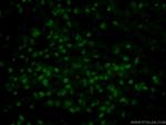 SOX2 Antibody in Immunohistochemistry (PFA fixed) (IHC (PFA))