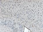 SOX2 Antibody in Immunohistochemistry (Paraffin) (IHC (P))