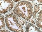 IGFBP2 Antibody in Immunohistochemistry (Paraffin) (IHC (P))