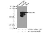 IGFBP2 Antibody in Immunoprecipitation (IP)