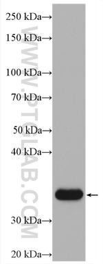 IGFBP2 Antibody in Western Blot (WB)