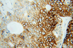 CA9 Antibody in Immunohistochemistry (Paraffin) (IHC (P))