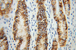 CA9 Antibody in Immunohistochemistry (Paraffin) (IHC (P))