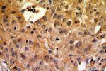 CA9 Antibody in Immunohistochemistry (Paraffin) (IHC (P))