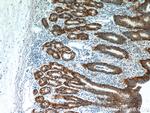 CA9 Antibody in Immunohistochemistry (Paraffin) (IHC (P))