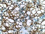 CA9 Antibody in Immunohistochemistry (Paraffin) (IHC (P))