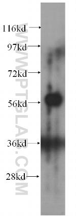 CA9 Antibody in Western Blot (WB)