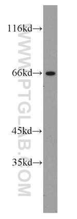 CA9 Antibody in Western Blot (WB)