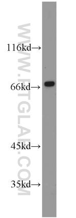 CA9 Antibody in Western Blot (WB)