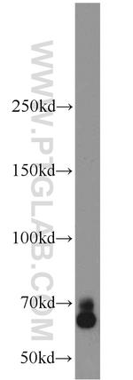 CA9 Antibody in Western Blot (WB)