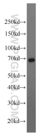 CA9 Antibody in Western Blot (WB)